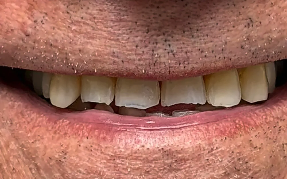 Patient’s smile before treatment