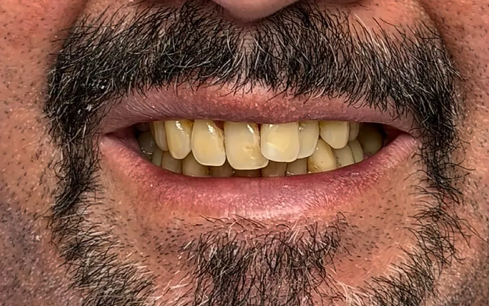 Patient’s smile before treatment