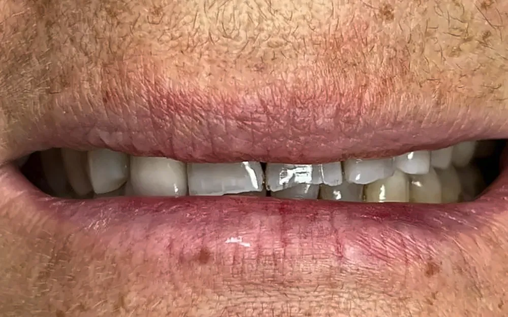 Patient’s smile before treatment