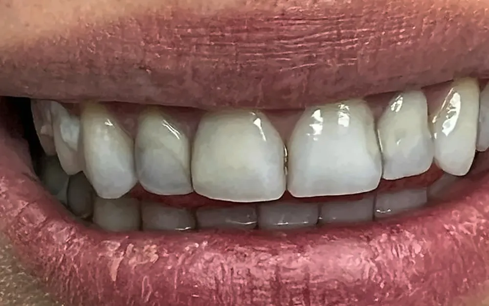Patient’s smile before treatment