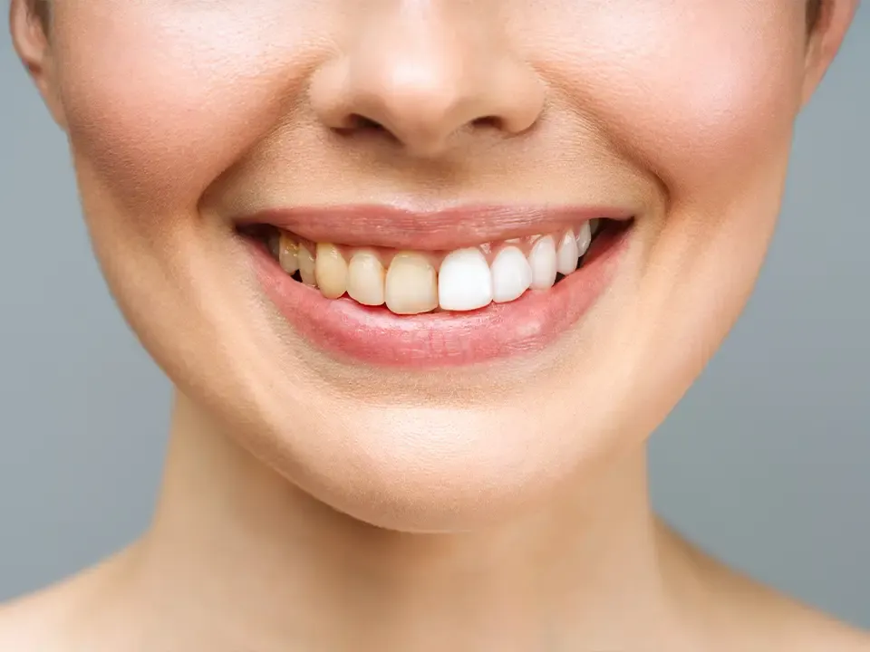 Close-up of a healthy smile