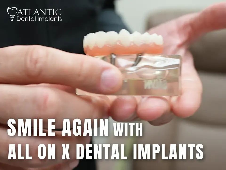 Smile Again With All on X Dental Implants