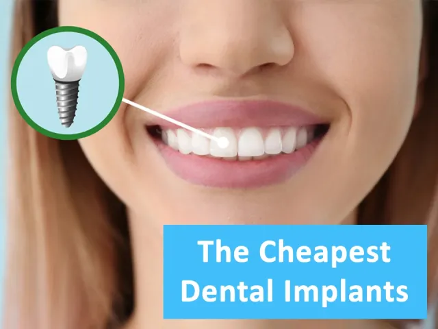 The Affordable Dental Implants at Atlantic Dental Group
