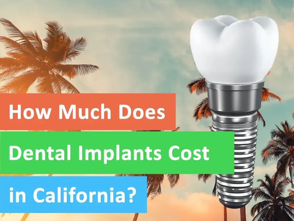 How Much Will Tooth Implant Cost With Insurance in California?