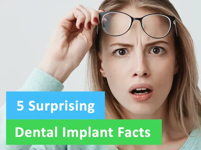 5 Surprising Dental Implant Facts