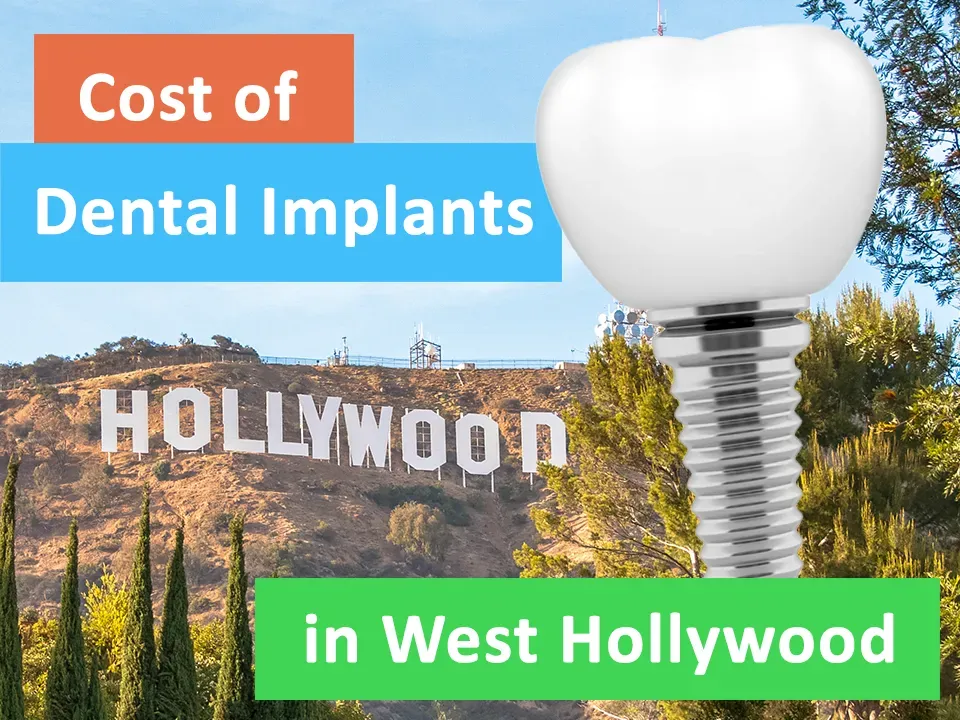 Dental Implants West Hollywood Cost Guide