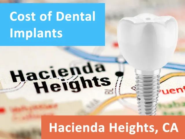 The Cost of Dental Implants in Hacienda Heights, CA