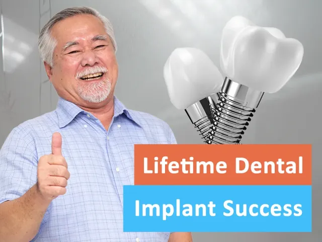 Finding Lifetime Success with Dental Implants