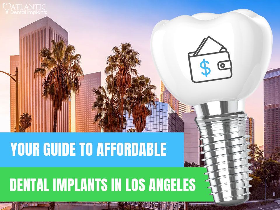 Your Guide to Affordable Dental Implants Los Angeles
