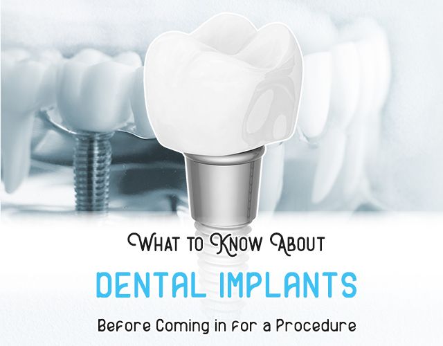 What to Know About the Dental Implants Procedure
