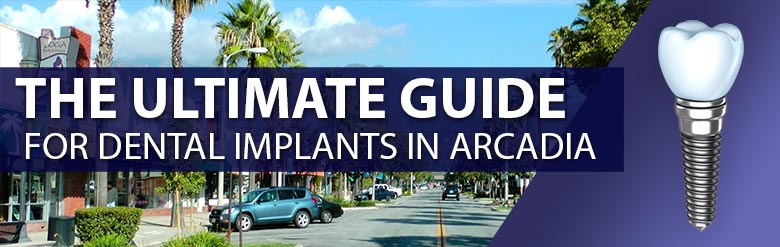 The Ultimate Guide for Dental Implants in Arcadia, California