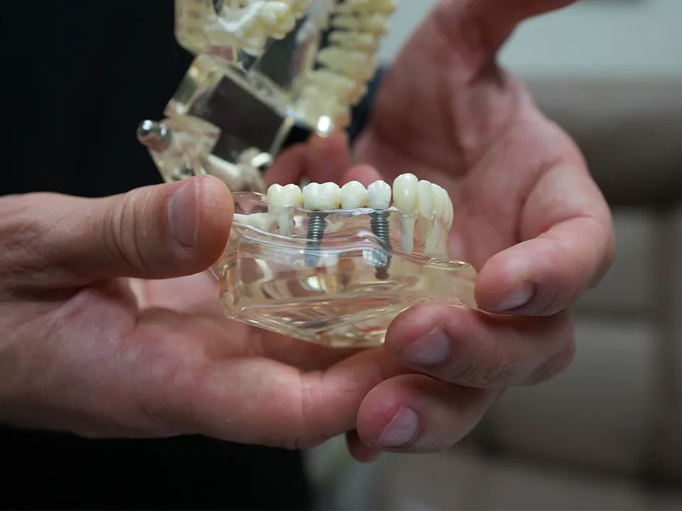 Dr. Paz explaining how jawbone deterioration is prevented by dental implants tooth implant cost with insurance