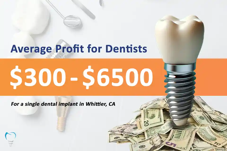 Average Profit per Dental Implant