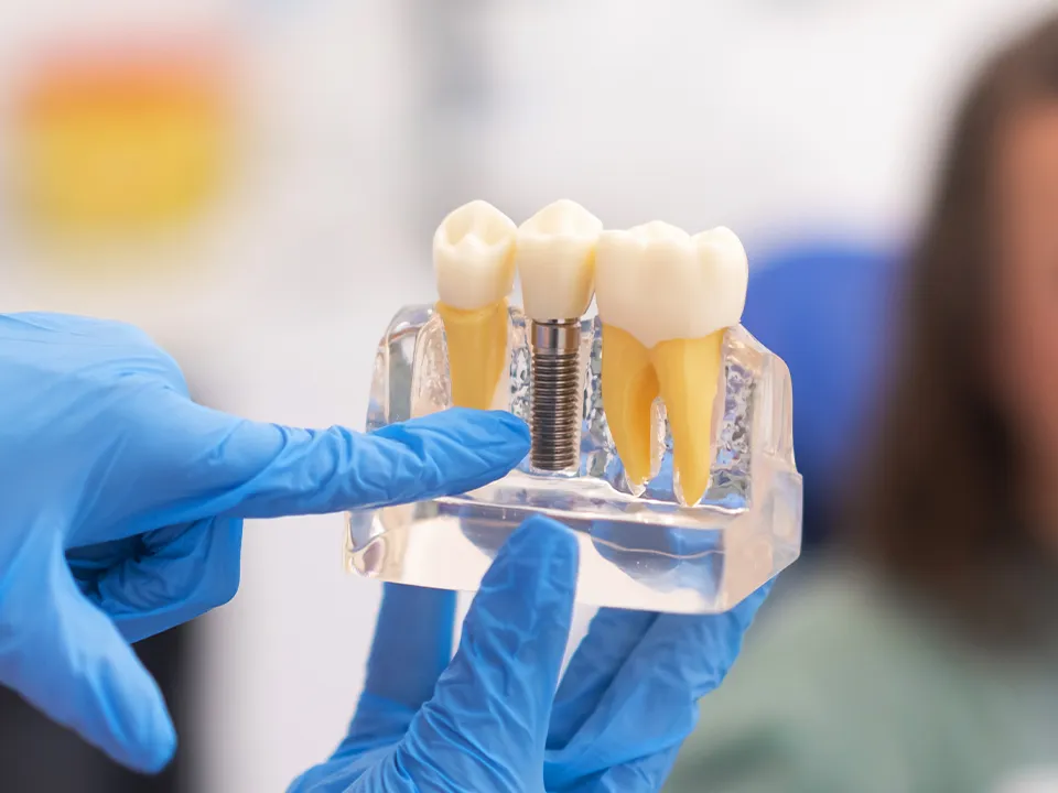 Dentist Explaining Dental Implant Behavior to Patient
