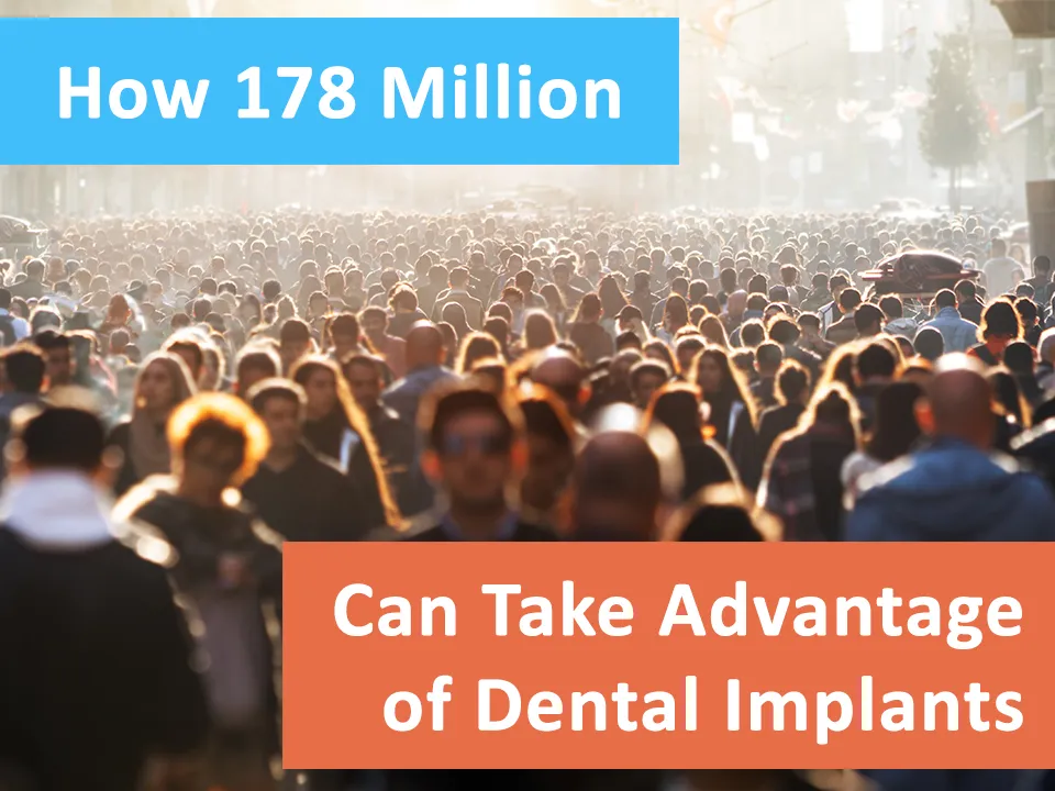 How 178 Million Americans can benefit from Dental Implants in Whittier, CA