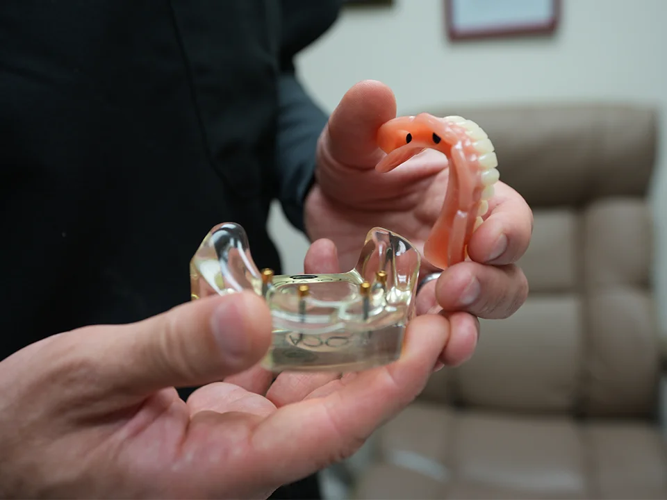 Permanent teeth are a fixed solution for missing teeth