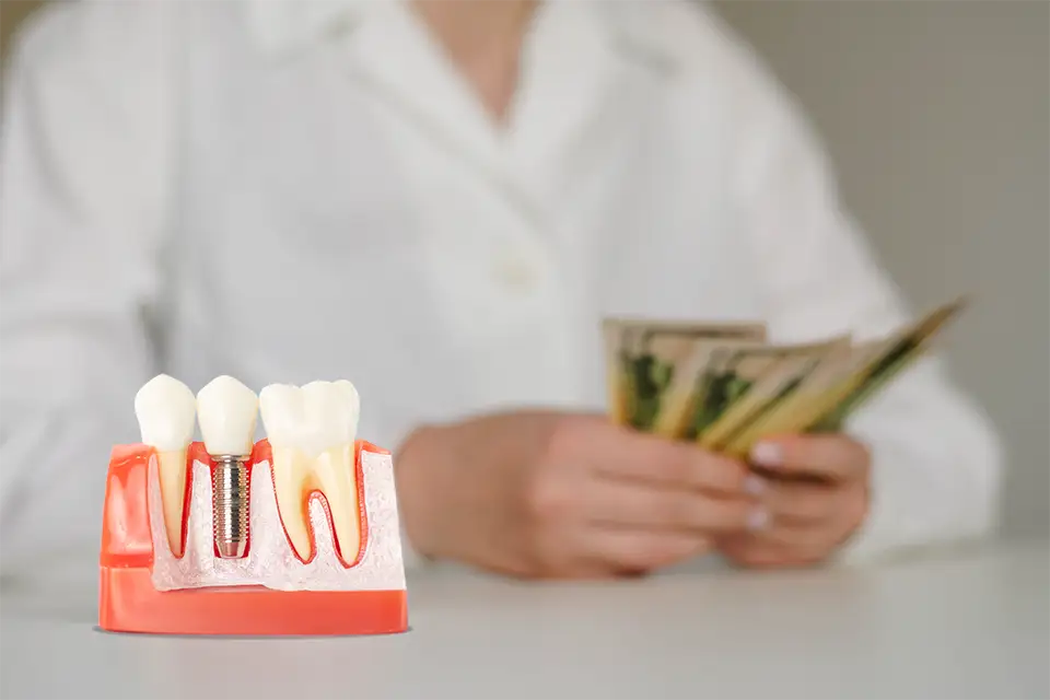 Understanding low cost dental implants in Los Angeles